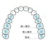 独特扩弓理念