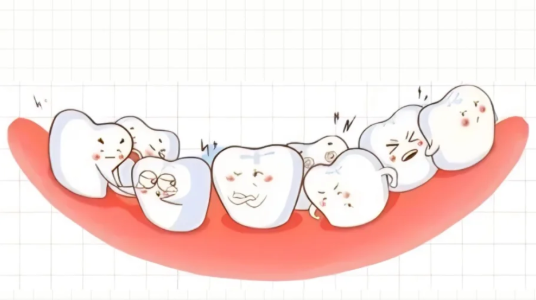 乳牙滞留，一定要拔除吗？